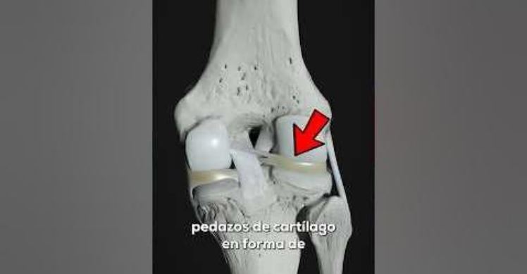 Así se ve una rodilla en movimiento